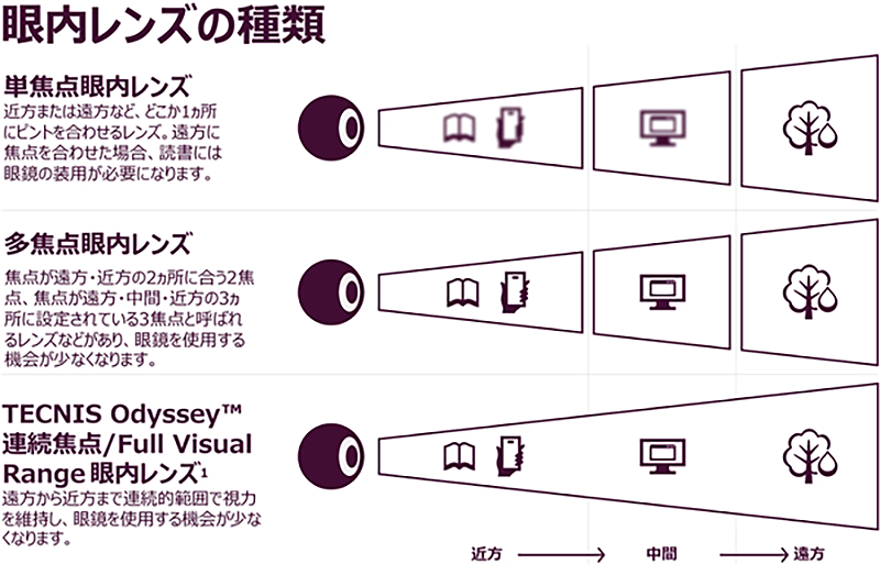 ３焦点自然視覚レンズ（連続焦点レンズ）-3