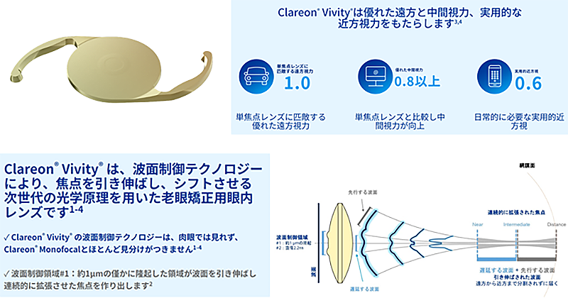 焦点深度拡張型自然視覚レンズ
Clareon Vivity（クラレオン　ビビティー）
