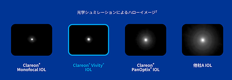 焦点深度拡張型自然視覚レンズ Clareon Vivity（クラレオン　ビビティー）2-0