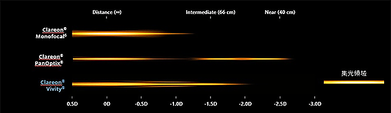 焦点深度拡張型自然視覚レンズ Clareon Vivity（クラレオン　ビビティー）4